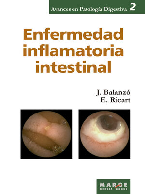 cover image of Enfermedad inflamatoria intestinal